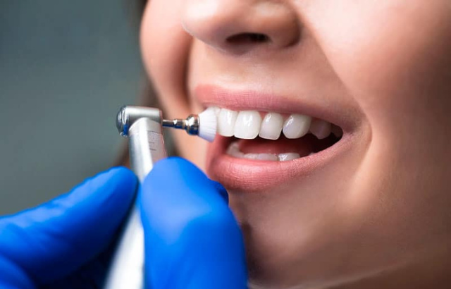 Limpieza de dientes profunda: ¿Por qué es importante para tu salud bucal?