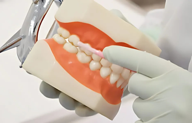 ¿Cómo se realiza una limpieza de dientes profunda en el dentista y qué esperar?