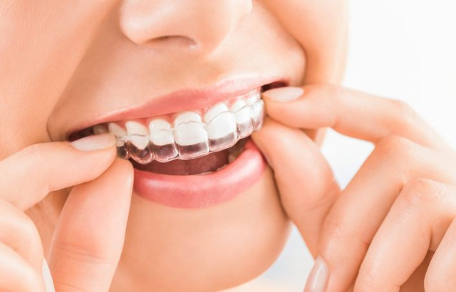 Aparato Invisible Precio y Financiamiento: Mejores Opciones para Tu Sonrisa en Las Palmas de Gran Canaria