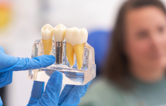 1 Implantes dentales