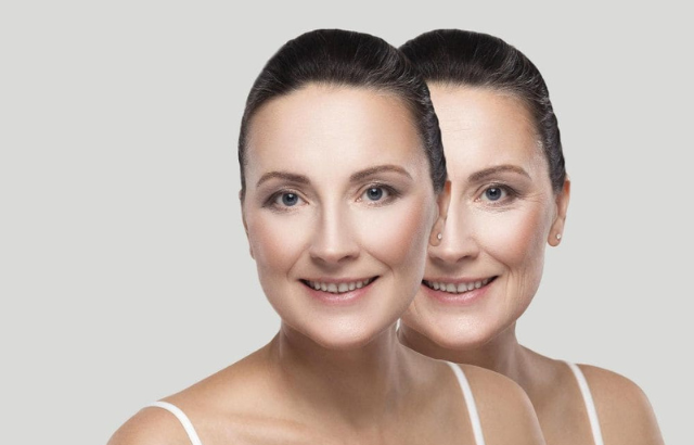¿Cómo Mejorar tu Perfil Facial? Guía Completa de Tratamientos de Armonización