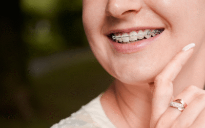 ¿Brackets o Invisalign? Descubre tu Ortodoncia Ideal con precios ideales para ti
