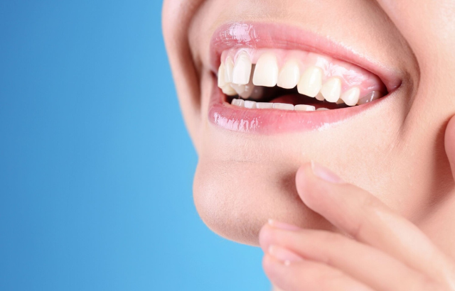 Más allá de la estética: Razones de salud para corregir los dientes separados