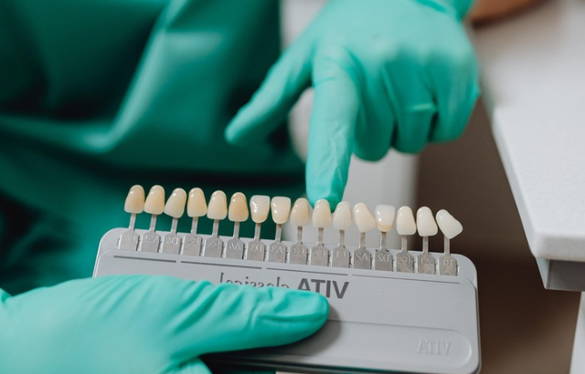 ¿Marketing o verdad? Carillas Dentales en España