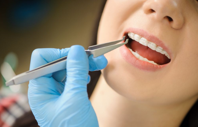 ¿Dientes separados? Guía definitiva de los tratamientos disponibles